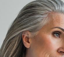 Gray hair